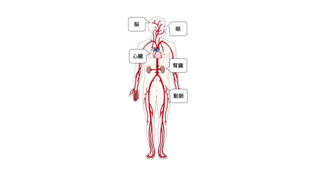 Hypertension mediated organ damage